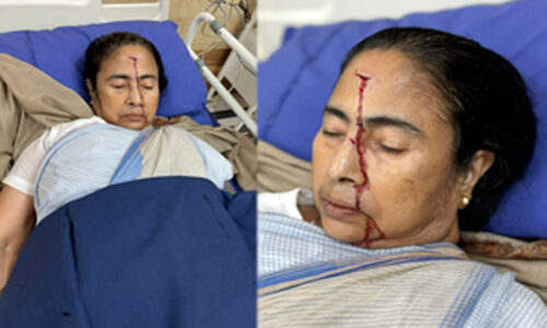 सीएम ममता बनर्जी को गंभीर चोट लगी, अस्पताल में भर्ती